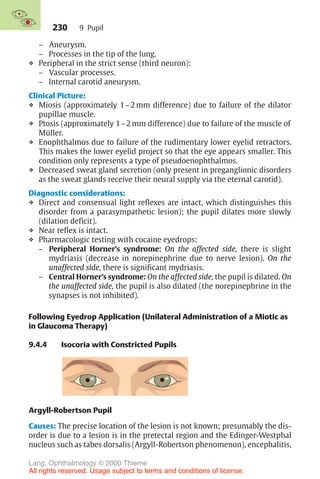 230
– Aneurysm.
– Processes in the tip of the lung.
❖ Peripheral in the strict sense (third neuron):
– Vascular processes.
– Internal carotid aneurysm.
Clinical Picture:
❖ Miosis (approximately 1–2 mm difference) due to failure of the dilator
pupillae muscle.
❖ Ptosis (approximately 1–2 mm difference) due to failure of the muscle of
Müller.
❖ Enophthalmos due to failure of the rudimentary lower eyelid retractors.
This makes the lower eyelid project so that the eye appears smaller. This
condition only represents a type of pseudoenophthalmos.
❖ Decreased sweat gland secretion (only present in preganglionic disorders
as the sweat glands receive their neural supply via the eternal carotid).
Diagnostic considerations:
❖ Direct and consensual light reflexes are intact, which distinguishes this
disorder from a parasympathetic lesion); the pupil dilates more slowly
(dilation deficit).
❖ Near reflex is intact.
❖ Pharmacologic testing with cocaine eyedrops:
– Peripheral Horner’s syndrome: On the affected side, there is slight
mydriasis (decrease in norepinephrine due to nerve lesion). On the
unaffected side, there is significant mydriasis.
– Central Horner’s syndrome: On the affected side, the pupil is dilated. On
the unaffected side, the pupil is also dilated (the norepinephrine in the
synapses is not inhibited).
Following Eyedrop Application (Unilateral Administration of a Miotic as
in Glaucoma Therapy)
9.4.4 Isocoria with Constricted Pupils
Argyll-Robertson Pupil
Causes: The precise location of the lesion is not known; presumably the dis-
order is due to a lesion is in the pretectal region and the Edinger-Westphal
nucleus such as tabes dorsalis (Argyll-Robertson phenomenon), encephalitis,
9 Pupil
Lang, Ophthalmology © 2000 Thieme
All rights reserved. Usage subject to terms and conditions of license.
 