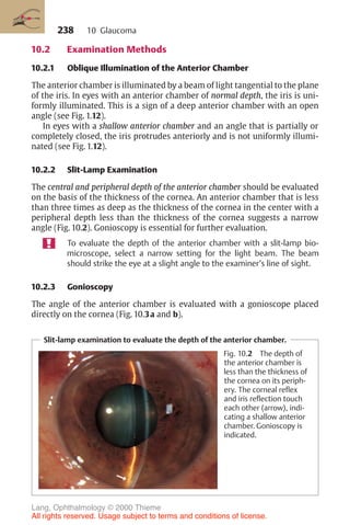 238
10.2 Examination Methods
10.2.1 Oblique Illumination of the Anterior Chamber
The anterior chamber is illuminated by a beam of light tangential to the plane
of the iris. In eyes with an anterior chamber of normal depth, the iris is uni-
formly illuminated. This is a sign of a deep anterior chamber with an open
angle (see Fig. 1.12).
In eyes with a shallow anterior chamber and an angle that is partially or
completely closed, the iris protrudes anteriorly and is not uniformly illumi-
nated (see Fig. 1.12).
10.2.2 Slit-Lamp Examination
The central and peripheral depth of the anterior chamber should be evaluated
on the basis of the thickness of the cornea. An anterior chamber that is less
than three times as deep as the thickness of the cornea in the center with a
peripheral depth less than the thickness of the cornea suggests a narrow
angle (Fig. 10.2). Gonioscopy is essential for further evaluation.
To evaluate the depth of the anterior chamber with a slit-lamp bio-
microscope, select a narrow setting for the light beam. The beam
should strike the eye at a slight angle to the examiner’s line of sight.
10.2.3 Gonioscopy
The angle of the anterior chamber is evaluated with a gonioscope placed
directly on the cornea (Fig. 10.3a and b).
Slit-lamp examination to evaluate the depth of the anterior chamber.
Fig. 10.2 The depth of
the anterior chamber is
less than the thickness of
the cornea on its periph-
ery. The corneal reflex
and iris reflection touch
each other (arrow), indi-
cating a shallow anterior
chamber. Gonioscopy is
indicated.
10 Glaucoma
Lang, Ophthalmology © 2000 Thieme
All rights reserved. Usage subject to terms and conditions of license.
 