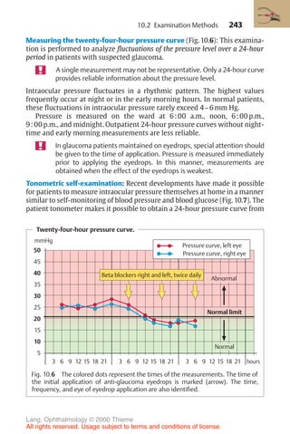 243
Measuring the twenty-four-hour pressure curve (Fig. 10.6): This examina-
tion is performed to analyze fluctuations of the pressure level over a 24-hour
period in patients with suspected glaucoma.
A single measurement may not be representative. Only a 24-hour curve
provides reliable information about the pressure level.
Intraocular pressure fluctuates in a rhythmic pattern. The highest values
frequently occur at night or in the early morning hours. In normal patients,
these fluctuations in intraocular pressure rarely exceed 4–6 mm Hg.
Pressure is measured on the ward at 6:00 a.m., noon, 6:00 p.m.,
9:00 p.m., and midnight. Outpatient 24-hour pressure curves without night-
time and early morning measurements are less reliable.
In glaucoma patients maintained on eyedrops, special attention should
be given to the time of application. Pressure is measured immediately
prior to applying the eyedrops. In this manner, measurements are
obtained when the effect of the eyedrops is weakest.
Tonometric self-examination: Recent developments have made it possible
for patients to measure intraocular pressure themselves at home in a manner
similar to self-monitoring of blood pressure and blood glucose (Fig. 10.7). The
patient tonometer makes it possible to obtain a 24-hour pressure curve from
10.2 Examination Methods
Twenty-four-hour pressure curve.
50
45
40
35
30
25
20
15
10
5
mmHg
3 6 9 12 15 18 21 3 6 9 12 15 18 21 3 6 9 12 15 18 21 hours
Normal limit
Abnormal
Normal
Beta blockers right and left, twice daily
Pressure curve, left eye
Pressure curve, right eye
Fig. 10.6 The colored dots represent the times of the measurements. The time of
the initial application of anti-glaucoma eyedrops is marked (arrow). The time,
frequency, and eye of eyedrop application are also identified.
Lang, Ophthalmology © 2000 Thieme
All rights reserved. Usage subject to terms and conditions of license.
 