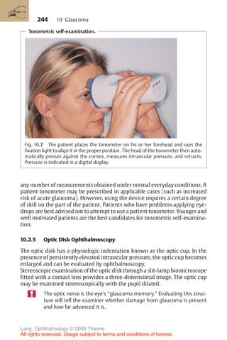 244
Tonometric self-examination.
Fig. 10.7 The patient places the tonometer on his or her forehead and uses the
fixation light to align it in the proper position. The head of the tonometer then auto-
matically presses against the cornea, measures intraocular pressure, and retracts.
Pressure is indicated in a digital display.
any number of measurements obtained under normal everyday conditions. A
patient tonometer may be prescribed in applicable cases (such as increased
risk of acute glaucoma). However, using the device requires a certain degree
of skill on the part of the patient. Patients who have problems applying eye-
drops are best advised not to attempt to use a patient tonometer. Younger and
well motivated patients are the best candidates for tonometric self-examina-
tion.
10.2.5 Optic Disk Ophthalmoscopy
The optic disk has a physiologic indentation known as the optic cup. In the
presence of persistently elevated intraocular pressure, the optic cup becomes
enlarged and can be evaluated by ophthalmoscopy.
Stereoscopic examination of the optic disk through a slit-lamp biomicroscope
fitted with a contact lens provides a three-dimensional image. The optic cup
may be examined stereoscopically with the pupil dilated.
The optic nerve is the eye’s “glaucoma memory.” Evaluating this struc-
ture will tell the examiner whether damage from glaucoma is present
and how far advanced it is.
10 Glaucoma
Lang, Ophthalmology © 2000 Thieme
All rights reserved. Usage subject to terms and conditions of license.
 