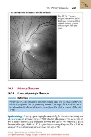 251
Examination of the retinal nerve fiber layer.
Fig. 10.13 The arc-
shaped nerve fiber defect
(between the arrows) is a
sign of an early glauco-
matous optic nerve le-
sion.
10.3 Primary Glaucoma
10.3.1 Primary Open Angle Glaucoma
Definition
Primary open angle glaucoma begins in middle-aged and elderly patients with
minimal symptoms that progressively worsen. The angle of the anterior cham-
ber characteristically remains open throughout the clinical course of the dis-
order.
Epidemiology: Primary open angle glaucoma is by far the most common form
of glaucoma and accounts for over 90% of adult glaucomas. The incidence of
the disorder significantly increases beyond the age of 40, reaching a peak
between the ages of 60 and 70. Its prevalence among 40-year-olds is 0.9% as
compared to 4.7% among patients over the age of 50.
10.3 Primary Glaucoma
Lang, Ophthalmology © 2000 Thieme
All rights reserved. Usage subject to terms and conditions of license.
 