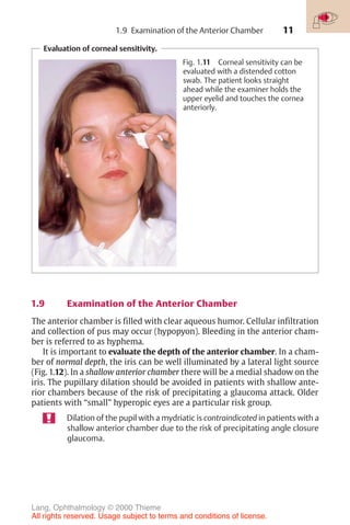 11
Evaluation of corneal sensitivity.
Fig. 1.11 Corneal sensitivity can be
evaluated with a distended cotton
swab. The patient looks straight
ahead while the examiner holds the
upper eyelid and touches the cornea
anteriorly.
1.9 Examination of the Anterior Chamber
1.9 Examination of the Anterior Chamber
The anterior chamber is filled with clear aqueous humor. Cellular infiltration
and collection of pus may occur (hypopyon). Bleeding in the anterior cham-
ber is referred to as hyphema.
It is important to evaluate the depth of the anterior chamber. In a cham-
ber of normal depth, the iris can be well illuminated by a lateral light source
(Fig. 1.12). In a shallow anterior chamber there will be a medial shadow on the
iris. The pupillary dilation should be avoided in patients with shallow ante-
rior chambers because of the risk of precipitating a glaucoma attack. Older
patients with “small” hyperopic eyes are a particular risk group.
Dilation of the pupil with a mydriatic is contraindicated in patients with a
shallow anterior chamber due to the risk of precipitating angle closure
glaucoma.
Lang, Ophthalmology © 2000 Thieme
All rights reserved. Usage subject to terms and conditions of license.
 