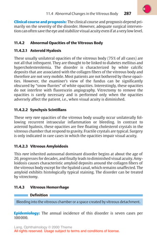 287
Clinical course and prognosis: The clinical course and prognosis depend pri-
marily on the severity of the disorder. However, adequate surgical interven-
tion can often save the eye and stabilize visual acuity even if at a very low level.
11.4.2 Abnormal Opacities of the Vitreous Body
11.4.2.1 Asteroid Hyalosis
These usually unilateral opacities of the vitreous body (75% of all cases) are
not all that infrequent. They are thought to be linked to diabetes mellitus and
hypercholesterolemia. The disorder is characterized by white calcific
deposits that are associated with the collagen fibers of the vitreous body and
therefore are not very mobile. Most patients are not bothered by these opaci-
ties. However, the examiner’s view of the fundus can be significantly
obscured by “snow flurries” of white opacities. Interestingly, these opacities
do not interfere with fluorescein angiography. Vitrectomy to remove the
opacities is rarely necessary and is performed only when the opacities
adversely affect the patient, i.e., when visual acuity is diminished.
11.4.2.2 Synchysis Scintillans
These very rare opacities of the vitreous body usually occur unilaterally fol-
lowing recurrent intraocular inflammation or bleeding. In contrast to
asteroid hyalosis, these opacities are free floating cholesterol crystals in the
vitreous chamber that respond to gravity. Fractile crystals are typical. Surgery
is only indicated in rare cases in which the opacities impair visual acuity.
11.4.2.3 Vitreous Amyloidosis
This rare inherited autosomal dominant disorder begins at about the age of
20, progresses for decades, and finally leads to diminished visual acuity. Amy-
loidosis causes characteristic amyloid deposits around the collagen fibers of
the vitreous body except for the hyaloid canal, which remains unaffected. The
amyloid exhibits histologically typical staining. The disorder can be treated
by vitrectomy.
11.4.3 Vitreous Hemorrhage
Definition
Bleeding into the vitreous chamber or a space created by vitreous detachment.
Epidemiology: The annual incidence of this disorder is seven cases per
100000.
11.4 Abnormal Changes in the Vitreous Body
Lang, Ophthalmology © 2000 Thieme
All rights reserved. Usage subject to terms and conditions of license.
 