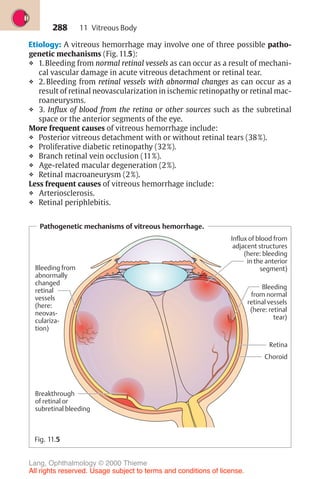 288
Etiology: A vitreous hemorrhage may involve one of three possible patho-
genetic mechanisms (Fig. 11.5):
❖ 1. Bleeding from normal retinal vessels as can occur as a result of mechani-
cal vascular damage in acute vitreous detachment or retinal tear.
❖ 2. Bleeding from retinal vessels with abnormal changes as can occur as a
result of retinal neovascularization in ischemic retinopathy or retinal mac-
roaneurysms.
❖ 3. Influx of blood from the retina or other sources such as the subretinal
space or the anterior segments of the eye.
More frequent causes of vitreous hemorrhage include:
❖ Posterior vitreous detachment with or without retinal tears (38%).
❖ Proliferative diabetic retinopathy (32%).
❖ Branch retinal vein occlusion (11%).
❖ Age-related macular degeneration (2%).
❖ Retinal macroaneurysm (2%).
Less frequent causes of vitreous hemorrhage include:
❖ Arteriosclerosis.
❖ Retinal periphlebitis.
Pathogenetic mechanisms of vitreous hemorrhage.
Choroid
Influx of blood from
adjacent structures
(here: bleeding
in the anterior
segment)
Retina
Bleeding
from normal
retinal vessels
(here: retinal
tear)
Breakthrough
of retinal or
subretinal bleeding
Bleeding from
abnormally
changed
retinal
vessels
(here:
neovas-
culariza-
tion)
Fig. 11.5
11 Vitreous Body
Lang, Ophthalmology © 2000 Thieme
All rights reserved. Usage subject to terms and conditions of license.
 