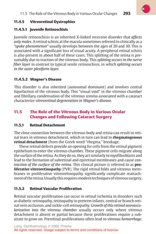 293
11.4.5 Vitreoretinal Dystrophies
11.4.5.1 Juvenile Retinoschisis
Juvenile retinoschisis is an inherited X-linked recessive disorder that affects
only males. A retinal schisis at the macula sometimes referred to clinically as a
“spoke phenomenon” usually develops between the ages of 20 and 30. This is
associated with a significant loss of visual acuity. A peripheral retinal schisis
is also present in about half of these cases. This splitting of the retina is pre-
sumably due to traction of the vitreous body. This splitting occurs in the nerve
fiber layer in contrast to typical senile retinoschisis, in which splitting occurs
in the outer plexiform layer.
11.4.5.2 Wagner’s Disease
This disorder is also inherited (autosomal dominant) and involves central
liquefaction of the vitreous body. This “visual void” in the vitreous chamber
and fibrillary condensation of the vitreous stroma associated with a cataract
characterize vitreoretinal degeneration in Wagner’s disease.
11.5 The Role of the Vitreous Body in Various Ocular
Changes and Following Cataract Surgery
11.5.1 Retinal Detachment
The close connection between the vitreous body and retina can result in reti-
nal tears in vitreous detachment, which in turn can lead to rhegmatogenous
retinal detachment (from the Greek word “rhegma,” breakage.
These retinal defects provide an opening for cells from the retinal pigment
epithelium to enter the vitreous chamber. These pigment cells migrate along
the surface of the retina. As they do so, they act similarly to myofibroblasts and
lead to the formation of subretinal and epiretinal membranes and cause con-
traction of the surface of the retina. This clinical picture is referred to as pro-
liferative vitreoretinopathy (PVR). The rigid retinal folds and vitreous mem-
branes in proliferative vitreoretinopathy significantly complicate reattach-
mentoftheretina.Usuallythisrequiresmoderntechniquesofvitreoussurgery.
11.5.2 Retinal Vascular Proliferation
Retinal vascular proliferation can occur in retinal ischemia in disorders such
as diabetic retinopathy, retinopathy in preterm infants, central or branch reti-
nal vein occlusion, and sickle-cell retinopathy. Growth of this retinal neovascu-
larization into the vitreous chamber usually occurs only where vitreous
detachment is absent or partial because these proliferations require a sub-
strate to grow on. Preretinal proliferations often lead to vitreous hemorrhage.
11.5 The Role of the Vitreous Body in Various Ocular Changes
Lang, Ophthalmology © 2000 Thieme
All rights reserved. Usage subject to terms and conditions of license.
 