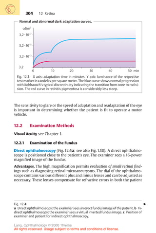 304
Normal and abnormal dark adaptation curves.
3,2 .10–3
3,2 .10–5
3,2
3,2 .10–7
0 10 20 30 40 50 min
cd/m2
Fig. 12.3 X axis: adaptation time in minutes. Y axis: luminance of the respective
test marker in candelas per square meter. The blue curve shows normal progression
with Kohlrausch’s typical discontinuity indicating the transition from cone to rod vi-
sion. The red curve in retinitis pigmentosa is considerably less steep.
The sensitivity to glare or the speed of adaptation and readaptation of the eye
is important in determining whether the patient is fit to operate a motor
vehicle.
12.2 Examination Methods
Visual Acuity see Chapter 1.
12.2.1 Examination of the Fundus
Direct ophthalmoscopy (Fig. 12.4a; see also Fig. 1.13): A direct ophthalmo-
scope is positioned close to the patient’s eye. The examiner sees a 16-power
magnified image of the fundus.
Advantages. The high magnification permits evaluation of small retinal find-
ings such as diagnosing retinal microaneurysms. The dial of the ophthalmo-
scope contains various different plus and minus lenses and can be adjusted as
necessary. These lenses compensate for refractive errors in both the patient
!
Fig. 12.4
a Direct ophthalmoscopy: the examiner sees an erect fundus image of the patient. b In-
direct ophthalmoscopy: the examiner sees a virtual inverted fundus image. c Position of
examiner and patient for indirect ophthalmoscopy.
12 Retina
Lang, Ophthalmology © 2000 Thieme
All rights reserved. Usage subject to terms and conditions of license.
 