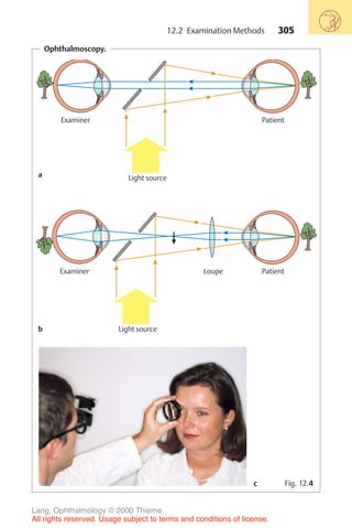 305
Ophthalmoscopy.
Light source
Examiner Patient
Light source
Examiner Patient
Loupe
a
b
Fig. 12.4
c
12.2 Examination Methods
Lang, Ophthalmology © 2000 Thieme
All rights reserved. Usage subject to terms and conditions of license.
 