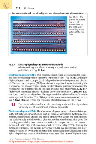 312
Farnsworth-Munsell test of red-green and blue-yellow color vision defects.
Fig. 12.11 The
patient must sort
markers of
various hues in
the right order
according to the
colors of the rain-
bow.
12.2.4 Electrophysiologic Examination Methods
(electroretinogram, electro-oculogram, and visual evoked
potentials; see Fig. 12.2a)
Electroretinogram (ERG): This examination method uses electrodes to rec-
ord the electrical response of the retina to flashes of light (Fig. 12.12a). Photopic
(light-adapted) and scotopic (dark-adapted) electroretinograms are obtain-
ed. The electroretinogram (ERG) consists of a negative A wave indicating the
response of the photoreceptors and a positive B wave primarily indicating the
response of the bipolar cells and the supporting cells of Müller (Fig. 12.12b). A
flicker ERG (repeated flashes) isolates pure cone response; a pattern ERG
(such as a checkerboard) and oscillating potentials can be used to evaluate the
inner layers of the retina. The ERG represents a summation response of the ret-
ina. A focal ERG can record the response of isolated areas of the retina.
The classic indication for an electroretinogram is retinitis pigmentosa
with early loss of scotopic and photopic potentials.
Electro-oculogram (EOG): The electro-oculogram detects abnormal changes
in the retinal pigment epithelium such as macular vitelliform dystrophy. This
examination method utilizes the dipole of the eye in which the cornea forms
the positive pole and the retinal pigment epithelium the negative pole. The
standing potential across cornea and retina in comparison to the cornea is
measured indirectly with two temporal electrodes (Fig. 12.13). During the
measuring process, the patient performs regular eye movements by alter-
nately focusing on two lights. The standing potential is normally higher in the
light-adapted eye than in the dark-adapted eye. The ratio of light-adapted
12 Retina
Lang, Ophthalmology © 2000 Thieme
All rights reserved. Usage subject to terms and conditions of license.
 
