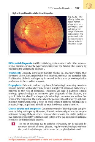 317
High-risk proliferative diabetic retinopathy.
Fig. 12.16 The
clearly visible vit-
reous hemor-
rhage seen here
(arrow) is a typi-
cal sign of this
stage of diabetic
retinopathy. The
patient will only
notice deteriora-
tion of vision in
this later stage.
Differential diagnosis: A differential diagnosis must exclude other vascular
retinal diseases, primarily hypertonic changes of the fundus (this is done by
excluding the underlying disorder).
Treatment: Clinically significant macular edema, i.e., macular edema that
threatens vision, is managed with focal laser treatment at the posterior pole.
Proliferative diabetic retinopathy is treated with scatter photocoagulation
performed in three to five sessions.
Prophylaxis: Failure to perform regular ophthalmologic screening examina-
tions in patients with diabetes mellitus is a negligent omission that exposes
patients to the risk of blindness. Therefore, all type II diabetics should
undergo ophthalmologic examination upon diagnosis of the disorder, and
type I diabetics should undergo ophthalmologic examination within five
years of the diagnosis. Thereafter, diabetic patients should undergo ophthal-
mologic examination once a year, or more often if diabetic retinopathy is
present. Pregnant patients should be examined once every trimester.
Clinical course and prognosis: Optimum control of blood glucose can pre-
vent or delay retinopathy. However, diabetic retinopathy can occur despite
optimum therapy. Rubeosis iridis (neovascularization in the iris) in prolifera-
tive diabetic retinopathy is tantamount to loss of the eye as rubeosis iridis is a
relentless and irreversible process.
The risk of blindness due to diabetic retinopathy can be reduced by
optimum control of blood glucose, regular ophthalmologic examina-
tion, and timely therapy, but it cannot be completely eliminated.
12.3 Vascular Disorders
Lang, Ophthalmology © 2000 Thieme
All rights reserved. Usage subject to terms and conditions of license.
 