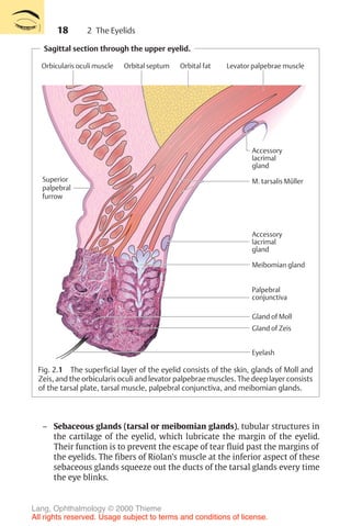 18
Sagittal section through the upper eyelid.
Accessory
lacrimal
gland
Accessory
lacrimal
gland
Superior
palpebral
furrow
M. tarsalis Müller
Meibomian gland
Palpebral
conjunctiva
Gland of Zeis
Gland of Moll
Eyelash
Orbital septum
Orbicularis oculi muscle Orbital fat Levator palpebrae muscle
Fig. 2.1 The superficial layer of the eyelid consists of the skin, glands of Moll and
Zeis, and the orbicularis oculi and levator palpebrae muscles. The deep layer consists
of the tarsal plate, tarsal muscle, palpebral conjunctiva, and meibomian glands.
– Sebaceous glands (tarsal or meibomian glands), tubular structures in
the cartilage of the eyelid, which lubricate the margin of the eyelid.
Their function is to prevent the escape of tear fluid past the margins of
the eyelids. The fibers of Riolan’s muscle at the inferior aspect of these
sebaceous glands squeeze out the ducts of the tarsal glands every time
the eye blinks.
2 The Eyelids
Lang, Ophthalmology © 2000 Thieme
All rights reserved. Usage subject to terms and conditions of license.
 
