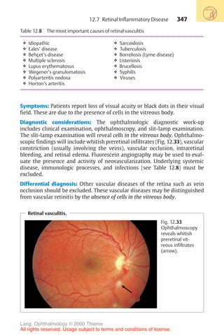 347
Table 12.8 The most important causes of retinal vasculitis
❖ Idiopathic
❖ Eales’ disease
❖ Behçet’s disease
❖ Multiple sclerosis
❖ Lupus erythematosus
❖ Wegener’s granulomatosis
❖ Polyarteritis nodosa
❖ Horton’s arteritis
❖ Sarcoidosis
❖ Tuberculosis
❖ Borreliosis (Lyme disease)
❖ Listeriosis
❖ Brucellosis
❖ Syphilis
❖ Viruses
Symptoms: Patients report loss of visual acuity or black dots in their visual
field. These are due to the presence of cells in the vitreous body.
Diagnostic considerations: The ophthalmologic diagnostic work-up
includes clinical examination, ophthalmoscopy, and slit-lamp examination.
The slit-lamp examination will reveal cells in the vitreous body. Ophthalmo-
scopic findings will include whitish preretinal infiltrates (Fig. 12.33), vascular
constriction (usually involving the veins), vascular occlusion, intraretinal
bleeding, and retinal edema. Fluorescein angiography may be used to eval-
uate the presence and activity of neovascularization. Underlying systemic
disease, immunologic processes, and infections (see Table 12.8) must be
excluded.
Differential diagnosis: Other vascular diseases of the retina such as vein
occlusion should be excluded. These vascular diseases may be distinguished
from vascular retinitis by the absence of cells in the vitreous body.
Retinal vasculitis.
Fig. 12.33
Ophthalmoscopy
reveals whitish
preretinal vit-
reous infiltrates
(arrow).
12.7 Retinal Inflammatory Disease
Lang, Ophthalmology © 2000 Thieme
All rights reserved. Usage subject to terms and conditions of license.
 