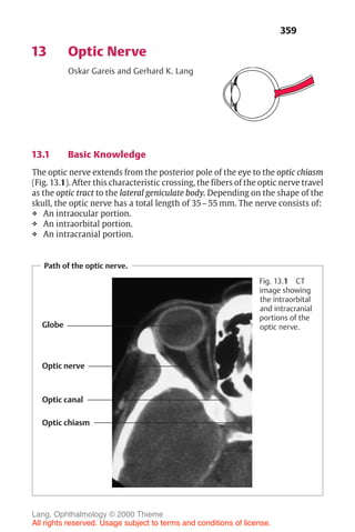 359
13 Optic Nerve
Oskar Gareis and Gerhard K. Lang
13.1 Basic Knowledge
The optic nerve extends from the posterior pole of the eye to the optic chiasm
(Fig. 13.1). After this characteristic crossing, the fibers of the optic nerve travel
as the optic tract to the lateral geniculate body. Depending on the shape of the
skull, the optic nerve has a total length of 35–55 mm. The nerve consists of:
❖ An intraocular portion.
❖ An intraorbital portion.
❖ An intracranial portion.
Path of the optic nerve.
Globe
Optic nerve
Optic canal
Optic chiasm
Fig. 13.1 CT
image showing
the intraorbital
and intracranial
portions of the
optic nerve.
Lang, Ophthalmology © 2000 Thieme
All rights reserved. Usage subject to terms and conditions of license.
 