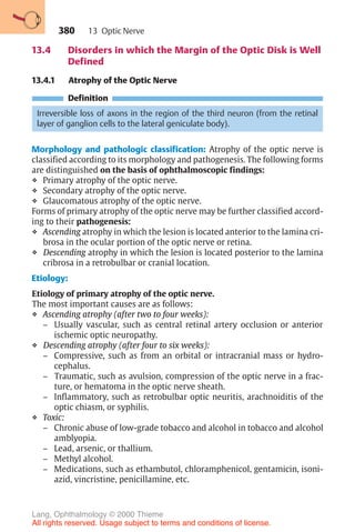 380
13.4 Disorders in which the Margin of the Optic Disk is Well
Defined
13.4.1 Atrophy of the Optic Nerve
Definition
Irreversible loss of axons in the region of the third neuron (from the retinal
layer of ganglion cells to the lateral geniculate body).
Morphology and pathologic classification: Atrophy of the optic nerve is
classified according to its morphology and pathogenesis. The following forms
are distinguished on the basis of ophthalmoscopic findings:
❖ Primary atrophy of the optic nerve.
❖ Secondary atrophy of the optic nerve.
❖ Glaucomatous atrophy of the optic nerve.
Forms of primary atrophy of the optic nerve may be further classified accord-
ing to their pathogenesis:
❖ Ascending atrophy in which the lesion is located anterior to the lamina cri-
brosa in the ocular portion of the optic nerve or retina.
❖ Descending atrophy in which the lesion is located posterior to the lamina
cribrosa in a retrobulbar or cranial location.
Etiology:
Etiology of primary atrophy of the optic nerve.
The most important causes are as follows:
❖ Ascending atrophy (after two to four weeks):
– Usually vascular, such as central retinal artery occlusion or anterior
ischemic optic neuropathy.
❖ Descending atrophy (after four to six weeks):
– Compressive, such as from an orbital or intracranial mass or hydro-
cephalus.
– Traumatic, such as avulsion, compression of the optic nerve in a frac-
ture, or hematoma in the optic nerve sheath.
– Inflammatory, such as retrobulbar optic neuritis, arachnoiditis of the
optic chiasm, or syphilis.
❖ Toxic:
– Chronic abuse of low-grade tobacco and alcohol in tobacco and alcohol
amblyopia.
– Lead, arsenic, or thallium.
– Methyl alcohol.
– Medications, such as ethambutol, chloramphenicol, gentamicin, isoni-
azid, vincristine, penicillamine, etc.
13 Optic Nerve
Lang, Ophthalmology © 2000 Thieme
All rights reserved. Usage subject to terms and conditions of license.
 