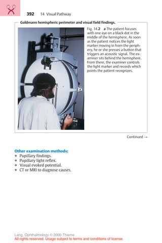 392
Goldmann hemispheric perimeter and visual field findings.
Fig. 14.2 a The patient focuses
with one eye on a black dot in the
middle of the hemisphere. As soon
as the patient notices the light
marker moving in from the periph-
ery, he or she presses a button that
triggers an acoustic signal. The ex-
aminer sits behind the hemisphere.
From there, the examiner controls
the light marker and records which
points the patient recognizes.
Continued !
Other examination methods:
❖ Pupillary findings.
❖ Pupillary light reflex.
❖ Visual evoked potential.
❖ CT or MRI to diagnose causes.
14 Visual Pathway
Lang, Ophthalmology © 2000 Thieme
All rights reserved. Usage subject to terms and conditions of license.
 