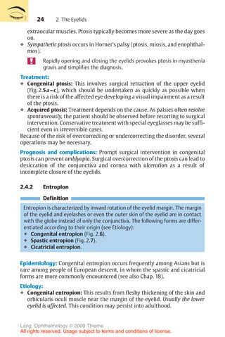 24
extraocular muscles. Ptosis typically becomes more severe as the day goes
on.
❖ Sympathetic ptosis occurs in Horner’s palsy (ptosis, miosis, and enophthal-
mos).
Rapidly opening and closing the eyelids provokes ptosis in myasthenia
gravis and simplifies the diagnosis.
Treatment:
❖ Congenital ptosis: This involves surgical retraction of the upper eyelid
(Fig. 2.5a–c), which should be undertaken as quickly as possible when
there is a risk of the affected eye developing a visual impairment as a result
of the ptosis.
❖ Acquired ptosis: Treatment depends on the cause. As palsies often resolve
spontaneously, the patient should be observed before resorting to surgical
intervention. Conservative treatment with special eyeglasses may be suffi-
cient even in irreversible cases.
Because of the risk of overcorrecting or undercorrecting the disorder, several
operations may be necessary.
Prognosis and complications: Prompt surgical intervention in congenital
ptosis can prevent amblyopia. Surgical overcorrection of the ptosis can lead to
desiccation of the conjunctiva and cornea with ulceration as a result of
incomplete closure of the eyelids.
2.4.2 Entropion
Definition
Entropion is characterized by inward rotation of the eyelid margin. The margin
of the eyelid and eyelashes or even the outer skin of the eyelid are in contact
with the globe instead of only the conjunctiva. The following forms are differ-
entiated according to their origin (see Etiology):
❖ Congenital entropion (Fig. 2.6).
❖ Spastic entropion (Fig. 2.7).
❖ Cicatricial entropion.
Epidemiology: Congenital entropion occurs frequently among Asians but is
rare among people of European descent, in whom the spastic and cicatricial
forms are more commonly encountered (see also Chap. 18).
Etiology:
❖ Congenital entropion: This results from fleshy thickening of the skin and
orbicularis oculi muscle near the margin of the eyelid. Usually the lower
eyelid is affected. This condition may persist into adulthood.
2 The Eyelids
Lang, Ophthalmology © 2000 Thieme
All rights reserved. Usage subject to terms and conditions of license.
 