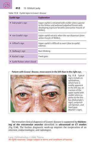 412
Table 15.3 Eyelid signs in Graves’ disease
Eyelid sign Explanation
❖ Dalrymple’s sign Upper eyelid is retracted with visible sclera superior
to the limbus and widened palpebral fissure with
developing exposure keratitis (overactive muscle of
Müller).
❖ von Graefe’s sign Upper eyelid retracts when the eye depresses (over-
active muscle of Müller).
❖ Gifford’s sign Upper eyelid is difficult to evert (due to eyelid
edema).
❖ Stellwag’s sign Rare blinking.
❖ Kocher’s sign Fixed gaze.
❖ Eyelid flutters when closed
Patient with Graves’ disease, more severe in the left than in the right eye.
Fig. 15.3 Typical
signs include ex-
ophthalmos,
which here is
readily apparent
in the left eye, re-
traction of the
upper eyelid with
visible sclera su-
perior to the lim-
bus (Dalrymple’s
sign), conjuncti-
val injection, and
fixed gaze
(Kocher’s sign).
The tentative clinical diagnosis of Graves’ disease is supported by thicken-
ing of the extraocular muscles identified in ultrasound or CT studies
(Fig. 15.4). The further diagnostic work-up requires the cooperation of an
internist, endocrinologist, and radiologist.
15 Orbital Cavity
Lang, Ophthalmology © 2000 Thieme
All rights reserved. Usage subject to terms and conditions of license.
 