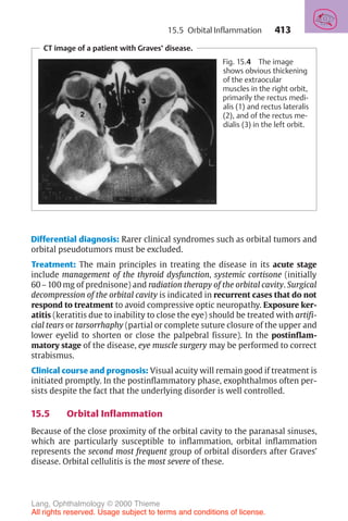 413
CT image of a patient with Graves’ disease.
Fig. 15.4 The image
shows obvious thickening
of the extraocular
muscles in the right orbit,
primarily the rectus medi-
alis (1) and rectus lateralis
(2), and of the rectus me-
dialis (3) in the left orbit.
Differential diagnosis: Rarer clinical syndromes such as orbital tumors and
orbital pseudotumors must be excluded.
Treatment: The main principles in treating the disease in its acute stage
include management of the thyroid dysfunction, systemic cortisone (initially
60–100 mg of prednisone) and radiation therapy of the orbital cavity. Surgical
decompression of the orbital cavity is indicated in recurrent cases that do not
respond to treatment to avoid compressive optic neuropathy. Exposure ker-
atitis (keratitis due to inability to close the eye) should be treated with artifi-
cial tears or tarsorrhaphy (partial or complete suture closure of the upper and
lower eyelid to shorten or close the palpebral fissure). In the postinflam-
matory stage of the disease, eye muscle surgery may be performed to correct
strabismus.
Clinical course and prognosis: Visual acuity will remain good if treatment is
initiated promptly. In the postinflammatory phase, exophthalmos often per-
sists despite the fact that the underlying disorder is well controlled.
15.5 Orbital Inflammation
Because of the close proximity of the orbital cavity to the paranasal sinuses,
which are particularly susceptible to inflammation, orbital inflammation
represents the second most frequent group of orbital disorders after Graves’
disease. Orbital cellulitis is the most severe of these.
15.5 Orbital Inflammation
Lang, Ophthalmology © 2000 Thieme
All rights reserved. Usage subject to terms and conditions of license.
 