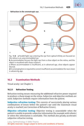 429
Refraction in the emmetropic eye.
a
c
b
d
Fig. 16.6 a Parallel light rays entering the eye from optical infinity are focused on
the retina in an unaccommodated eye.
b Accommodation focuses the light rays from a close object on the retina, and the
object is visualized with sharp contours.
c Where accommodation is insufficient, as in advanced age, close objects appear
blurred.
d A converging lens is required to correct insufficient accommodation for near vision
in advancing age.
16.2 Examination Methods
Visual acuity: see Chapter 1.
16.2.1 Refraction Testing
Refraction testing means measuring the additional refractive power required
to produce a sharp image on the retina. Subjective and objective methods are
used. Subjective methods require information from the patient.
Subjective refraction testing: This consists of successively placing various
combinations of lenses before the patient’s eye until the maximum visual
acuity is reached (see Correction of Refractive Errors).
Objective refraction testing: Objective testing is unavoidable when the
patient is unable to provide subjective information (for example with infants)
or when this information is unreliable. This method also greatly accelerates
subjective refractive testing.
16.2 Examination Methods
Lang, Ophthalmology © 2000 Thieme
All rights reserved. Usage subject to terms and conditions of license.
 