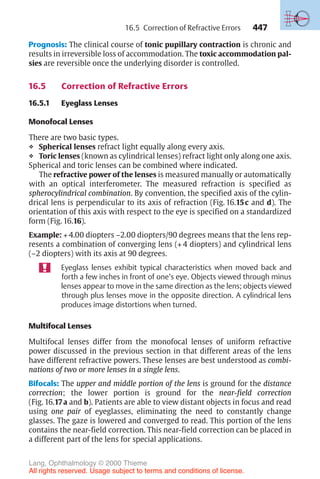 447
Prognosis: The clinical course of tonic pupillary contraction is chronic and
results in irreversible loss of accommodation. The toxic accommodation pal-
sies are reversible once the underlying disorder is controlled.
16.5 Correction of Refractive Errors
16.5.1 Eyeglass Lenses
Monofocal Lenses
There are two basic types.
❖ Spherical lenses refract light equally along every axis.
❖ Toric lenses (known as cylindrical lenses) refract light only along one axis.
Spherical and toric lenses can be combined where indicated.
The refractive power of the lenses is measured manually or automatically
with an optical interferometer. The measured refraction is specified as
spherocylindrical combination. By convention, the specified axis of the cylin-
drical lens is perpendicular to its axis of refraction (Fig. 16.15c and d). The
orientation of this axis with respect to the eye is specified on a standardized
form (Fig. 16.16).
Example: + 4.00 diopters –2.00 diopters/90 degrees means that the lens rep-
resents a combination of converging lens (+ 4 diopters) and cylindrical lens
(–2 diopters) with its axis at 90 degrees.
Eyeglass lenses exhibit typical characteristics when moved back and
forth a few inches in front of one’s eye. Objects viewed through minus
lenses appear to move in the same direction as the lens; objects viewed
through plus lenses move in the opposite direction. A cylindrical lens
produces image distortions when turned.
Multifocal Lenses
Multifocal lenses differ from the monofocal lenses of uniform refractive
power discussed in the previous section in that different areas of the lens
have different refractive powers. These lenses are best understood as combi-
nations of two or more lenses in a single lens.
Bifocals: The upper and middle portion of the lens is ground for the distance
correction; the lower portion is ground for the near-field correction
(Fig. 16.17a and b). Patients are able to view distant objects in focus and read
using one pair of eyeglasses, eliminating the need to constantly change
glasses. The gaze is lowered and converged to read. This portion of the lens
contains the near-field correction. This near-field correction can be placed in
a different part of the lens for special applications.
16.5 Correction of Refractive Errors
Lang, Ophthalmology © 2000 Thieme
All rights reserved. Usage subject to terms and conditions of license.
 