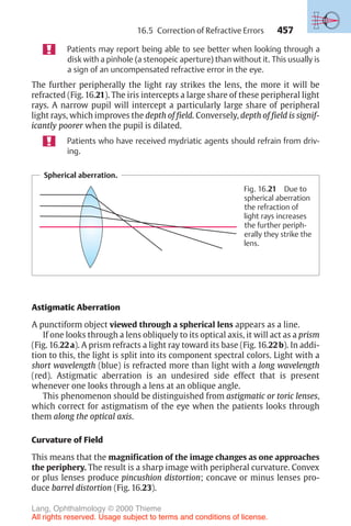 457
Patients may report being able to see better when looking through a
disk with a pinhole (a stenopeic aperture) than without it. This usually is
a sign of an uncompensated refractive error in the eye.
The further peripherally the light ray strikes the lens, the more it will be
refracted (Fig. 16.21). The iris intercepts a large share of these peripheral light
rays. A narrow pupil will intercept a particularly large share of peripheral
light rays, which improves the depth of field. Conversely, depth of field is signif-
icantly poorer when the pupil is dilated.
Patients who have received mydriatic agents should refrain from driv-
ing.
Spherical aberration.
Fig. 16.21 Due to
spherical aberration
the refraction of
light rays increases
the further periph-
erally they strike the
lens.
16.5 Correction of Refractive Errors
Astigmatic Aberration
A punctiform object viewed through a spherical lens appears as a line.
If one looks through a lens obliquely to its optical axis, it will act as a prism
(Fig. 16.22a). A prism refracts a light ray toward its base (Fig. 16.22b). In addi-
tion to this, the light is split into its component spectral colors. Light with a
short wavelength (blue) is refracted more than light with a long wavelength
(red). Astigmatic aberration is an undesired side effect that is present
whenever one looks through a lens at an oblique angle.
This phenomenon should be distinguished from astigmatic or toric lenses,
which correct for astigmatism of the eye when the patients looks through
them along the optical axis.
Curvature of Field
This means that the magnification of the image changes as one approaches
the periphery. The result is a sharp image with peripheral curvature. Convex
or plus lenses produce pincushion distortion; concave or minus lenses pro-
duce barrel distortion (Fig. 16.23).
Lang, Ophthalmology © 2000 Thieme
All rights reserved. Usage subject to terms and conditions of license.
 