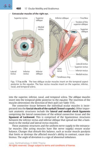 460
Extraocular muscles of the right eye.
Superior rectus
Lateral
rectus
Medial
rectus
Inferior
rectus
Inferior
oblique
Superior
oblique
Inferior oblique
Optic
nerve
Tendinous ring
Trochlea
Tendon of the
superior oblique
Superior
oblique
Inferior rectus
Lateral rectus
Superior rectus
Medial rectus
Figs. 17.1a and b The two oblique ocular muscles insert on the temporal aspect
posterior to the equator. The four rectus muscles insert on the superior, inferior,
nasal, and temporal sclera.
into the superior, inferior, nasal, and temporal sclera. The oblique muscles
insert into the temporal globe posterior to the equator. The insertion of the
muscles determines the direction of their pull (see Table 17.1).
The connective tissue between the individual ocular muscles is incor-
porated into the fascial sheath of the eyeball (Tenon’s capsule). Other impor-
tant anatomic structures include the lateral and medial check ligaments
comprising the lateral connections of the orbital connective tissue and the
ligament of Lockwood. This is comprised of the ligamentous structures
between the inferior rectus and inferior oblique that spread out like a ham-
mock to the medial and lateral rectus muscles.
These anatomic structures and the uniform nerve supply to the extraocu-
lar muscles (like acting muscles have like nerve supply) ensure ocular
balance. Changes that disturb this balance, such as ocular muscle paralysis
that limits or destroys the affected muscle’s ability to contract, cause stra-
bismus. The angle of deviation is a sign of abnormal imbalance.
17 Ocular Motility and Strabismus
Lang, Ophthalmology © 2000 Thieme
All rights reserved. Usage subject to terms and conditions of license.
 