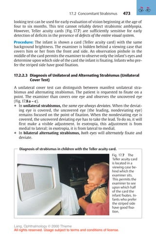 473
looking test can be used for early evaluation of vision beginning at the age of
four to six months. This test cannot reliably detect strabismic amblyopia.
However, Teller acuity cards (Fig. 17.7) are sufficiently sensitive for early
detection of deficits in the presence of defects of the entire visual system.
Procedure: The infant is shown a card (Teller acuity card) with the same
background brightness. The examiner is hidden behind a viewing case that
covers him or her from the front and side. An observation pinhole in the
middle of the card permits the examiner to observe only the infant’s eyes and
determine upon which side of the card the infant is fixating. Infants who pre-
fer the striped side have good fixation.
17.2.2.3 Diagnosis of Unilateral and Alternating Strabismus (Unilateral
Cover Test)
A unilateral cover test can distinguish between manifest unilateral stra-
bismus and alternating strabismus. The patient is requested to fixate on a
point. The examiner than covers one eye and observes the uncovered eye
(Fig. 17.8a – c).
❖ In unilateral strabismus, the same eye always deviates. When the deviat-
ing eye is covered, the uncovered eye (the leading, nondeviating eye)
remains focused on the point of fixation. When the nondeviating eye is
covered, the uncovered deviating eye has to take the lead. To do so, it will
first make a visible adjustment. In esotropia, this adjustment is from
medial to lateral; in exotropia, it is from lateral to medial.
❖ In bilateral alternating strabismus, both eyes will alternately fixate and
deviate.
Diagnosis of strabismus in children with the Teller acuity card.
Fig. 17.7 The
Teller acuity card
is located in a
viewing case be-
hind which the
examiner sits.
This permits the
examiner to see
upon which half
of the card the
infant fixates. In-
fants who prefer
the striped side
have good fixa-
tion.
17.2 Concomitant Strabismus
Lang, Ophthalmology © 2000 Thieme
All rights reserved. Usage subject to terms and conditions of license.
 