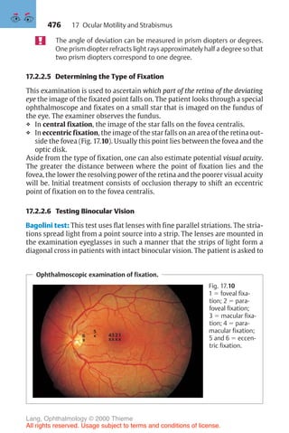 476
The angle of deviation can be measured in prism diopters or degrees.
One prism diopter refracts light rays approximately half a degree so that
two prism diopters correspond to one degree.
17.2.2.5 Determining the Type of Fixation
This examination is used to ascertain which part of the retina of the deviating
eye the image of the fixated point falls on. The patient looks through a special
ophthalmoscope and fixates on a small star that is imaged on the fundus of
the eye. The examiner observes the fundus.
❖ In central fixation, the image of the star falls on the fovea centralis.
❖ In eccentric fixation, the image of the star falls on an area of the retina out-
side the fovea (Fig. 17.10). Usually this point lies between the fovea and the
optic disk.
Aside from the type of fixation, one can also estimate potential visual acuity.
The greater the distance between where the point of fixation lies and the
fovea, the lower the resolving power of the retina and the poorer visual acuity
will be. Initial treatment consists of occlusion therapy to shift an eccentric
point of fixation on to the fovea centralis.
Ophthalmoscopic examination of fixation.
5
x 3
x
6
x
2
x
1
x
4
x
Fig. 17.10
1 ! foveal fixa-
tion; 2 ! para-
foveal fixation;
3 ! macular fixa-
tion; 4 ! para-
macular fixation;
5 and 6 ! eccen-
tric fixation.
17.2.2.6 Testing Binocular Vision
Bagolini test: This test uses flat lenses with fine parallel striations. The stria-
tions spread light from a point source into a strip. The lenses are mounted in
the examination eyeglasses in such a manner that the strips of light form a
diagonal cross in patients with intact binocular vision. The patient is asked to
17 Ocular Motility and Strabismus
Lang, Ophthalmology © 2000 Thieme
All rights reserved. Usage subject to terms and conditions of license.
 