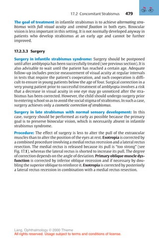 479
The goal of treatment in infantile strabismus is to achieve alternating stra-
bismus with full visual acuity and central fixation in both eyes. Binocular
vision is less important in this setting. It is not normally developed anyway in
patients who develop strabismus at an early age and cannot be further
improved.
17.2.3.3 Surgery
Surgery in infantile strabismus syndrome: Surgery should be postponed
until after amblyopia has been successfully treated (see previous section). It is
also advisable to wait until the patient has reached a certain age. Adequate
follow-up includes precise measurement of visual acuity at regular intervals
in tests that require the patient’s cooperation, and such cooperation is diffi-
cult to ensure in young patients below the age of four. Surgical correction in a
very young patient prior to successful treatment of amblyopia involves a risk
that a decrease in visual acuity in one eye may go unnoticed after the stra-
bismus has been corrected. However, the child should undergo surgery prior
to entering school so as to avoid the social stigma of strabismus. In such a case,
surgery achieves only a cosmetic correction of strabismus.
Surgery in late strabismus with normal sensory development: In this
case, surgery should be performed as early as possible because the primary
goal is to preserve binocular vision, which is necessarily absent in infantile
strabismus syndrome.
Procedure: The effect of surgery is less to alter the pull of the extraocular
muscles than to alter the position of the eyes at rest. Esotropia is corrected by
a combined procedure involving a medial rectus recession and a lateral rectus
resection. The medial rectus is released because its pull is “too strong” (see
Fig. 17.1), whereas the lateral rectus is shorted to increase its pull. The degree
of correction depends on the angle of deviation. Primary oblique muscle dys-
function is corrected by inferior oblique recession and if necessary by dou-
bling the superior oblique to reinforce it. Exotropia is corrected by posteriorly
a lateral rectus recession in combination with a medial rectus resection.
17.2 Concomitant Strabismus
Lang, Ophthalmology © 2000 Thieme
All rights reserved. Usage subject to terms and conditions of license.
 