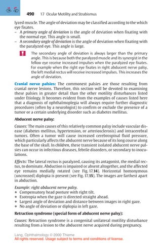 490
lyzed muscle. The angle of deviation may be classified according to the which
eye fixates.
– A primary angle of deviation is the angle of deviation when fixating with
the normal eye. This angle is small.
– A secondary angle of deviation is the angle of deviation when fixating with
the paralyzed eye. This angle is large.
The secondary angle of deviation is always larger than the primary
angle. This is because both the paralyzed muscle and its synergist in the
fellow eye receive increased impulses when the paralyzed eye fixates.
For example when the right eye fixates in right abducent nerve palsy,
the left medial rectus will receive increased impulses. This increases the
angle of deviation.
Cranial nerve palsies: The commonest palsies are those resulting from
cranial nerve lesions. Therefore, this section will be devoted to examining
these palsies in greater detail than the other motility disturbances listed
under Etiology. It becomes evident from the examples of causes listed here
that a diagnosis of ophthalmoplegia will always require further diagnostic
procedures (often by a neurologist) to confirm or exclude the presence of a
tumor or a certain underlying disorder such as diabetes mellitus.
Abducent nerve palsy:
Causes: The main causes of this relatively common palsy include vascular dis-
ease (diabetes mellitus, hypertension, or arteriosclerosis) and intracerebral
tumors. Often a tumor will cause increased cerebrospinal fluid pressure,
which particularly affects the abducent nerve because of its long course along
the base of the skull. In children, these transient isolated abducent nerve pal-
sies can occur in infectious diseases, febrile disorders, or secondary to inocu-
lations.
Effects: The lateral rectus is paralyzed, causing its antagonist, the medial rec-
tus, to dominate. Abduction is impaired or absent altogether, and the affected
eye remains medially rotated (see Fig. 17.14). Horizontal homonymous
(uncrossed) diplopia is present (see Fig. 17.15). The images are farthest apart
in abduction.
Example: right abducent nerve palsy.
❖ Compensatory head posture with right tilt.
❖ Esotropia when the gaze is directed straight ahead.
❖ Largest angle of deviation and distance between images in right gaze.
❖ No angle of deviation or diplopia in left gaze.
Retraction syndrome (special form of abducent nerve palsy):
Causes: Retraction syndrome is a congenital unilateral motility disturbance
resulting from a lesion to the abducent nerve acquired during pregnancy.
17 Ocular Motility and Strabismus
Lang, Ophthalmology © 2000 Thieme
All rights reserved. Usage subject to terms and conditions of license.
 
