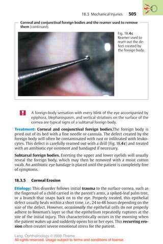 505
Corneal and conjunctival foreign bodies and the reamer used to remove
them (continued).
Fig. 18.4c
Reamer used to
ream out the de-
fect created by
the foreign body.
A foreign-body sensation with every blink of the eye accompanied by
epiphora, blepharospasm, and vertical striations on the surface of the
cornea are typical signs of a subtarsal foreign body.
Treatment: Corneal and conjunctival foreign bodies.The foreign body is
pried out of its bed with a fine needle or cannula. The defect created by the
foreign body will often be contaminated with rust or infiltrated with leuko-
cytes. This defect is carefully reamed out with a drill (Fig. 18.4c) and treated
with an antibiotic eye ointment and bandaged if necessary.
Subtarsal foreign bodies. Everting the upper and lower eyelids will usually
reveal the foreign body, which may then be removed with a moist cotton
swab. An antibiotic eye bandage is placed until the patient is completely free
of symptoms.
18.3.5 Corneal Erosion
Etiology: This disorder follows initial trauma to the surface cornea, such as
the fingernail of a child carried in the parent’s arms, a spiked-leaf palm tree,
or a branch that snaps back on to the eye. Properly treated, this epithelial
defect usually heals within a short time, i.e., 24 to 48 hours depending on the
size of the defect. However, occasionally the epithelial cells do not properly
adhere to Bowman’s layer so that the epithelium repeatedly ruptures at the
site of the initial injury. This characteristically occurs in the morning when
the patient wakes up and suddenly opens his or her eyes. This recurring ero-
sion often creates severe emotional stress for the patient.
18.3 Mechanical Injuries
Lang, Ophthalmology © 2000 Thieme
All rights reserved. Usage subject to terms and conditions of license.
 