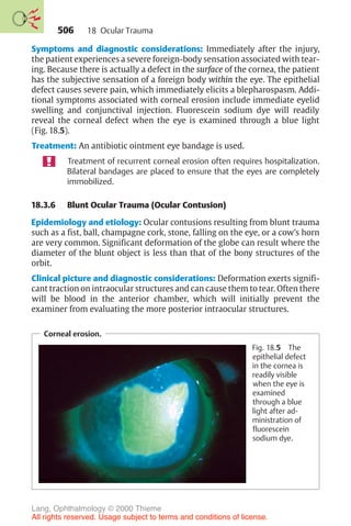 506
Symptoms and diagnostic considerations: Immediately after the injury,
the patient experiences a severe foreign-body sensation associated with tear-
ing. Because there is actually a defect in the surface of the cornea, the patient
has the subjective sensation of a foreign body within the eye. The epithelial
defect causes severe pain, which immediately elicits a blepharospasm. Addi-
tional symptoms associated with corneal erosion include immediate eyelid
swelling and conjunctival injection. Fluorescein sodium dye will readily
reveal the corneal defect when the eye is examined through a blue light
(Fig. 18.5).
Treatment: An antibiotic ointment eye bandage is used.
Treatment of recurrent corneal erosion often requires hospitalization.
Bilateral bandages are placed to ensure that the eyes are completely
immobilized.
18.3.6 Blunt Ocular Trauma (Ocular Contusion)
Epidemiology and etiology: Ocular contusions resulting from blunt trauma
such as a fist, ball, champagne cork, stone, falling on the eye, or a cow’s horn
are very common. Significant deformation of the globe can result where the
diameter of the blunt object is less than that of the bony structures of the
orbit.
Clinical picture and diagnostic considerations: Deformation exerts signifi-
cant traction on intraocular structures and can cause them to tear. Often there
will be blood in the anterior chamber, which will initially prevent the
examiner from evaluating the more posterior intraocular structures.
Corneal erosion.
Fig. 18.5 The
epithelial defect
in the cornea is
readily visible
when the eye is
examined
through a blue
light after ad-
ministration of
fluorescein
sodium dye.
18 Ocular Trauma
Lang, Ophthalmology © 2000 Thieme
All rights reserved. Usage subject to terms and conditions of license.
 