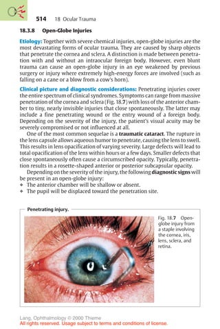514
18.3.8 Open-Globe Injuries
Etiology: Together with severe chemical injuries, open-globe injuries are the
most devastating forms of ocular trauma. They are caused by sharp objects
that penetrate the cornea and sclera. A distinction is made between penetra-
tion with and without an intraocular foreign body. However, even blunt
trauma can cause an open-globe injury in an eye weakened by previous
surgery or injury where extremely high-energy forces are involved (such as
falling on a cane or a blow from a cow’s horn).
Clinical picture and diagnostic considerations: Penetrating injuries cover
the entire spectrum of clinical syndromes. Symptoms can range from massive
penetration of the cornea and sclera (Fig. 18.7) with loss of the anterior cham-
ber to tiny, nearly invisible injuries that close spontaneously. The latter may
include a fine penetrating wound or the entry wound of a foreign body.
Depending on the severity of the injury, the patient’s visual acuity may be
severely compromised or not influenced at all.
One of the most common sequelae is a traumatic cataract. The rupture in
the lens capsule allows aqueous humor to penetrate, causing the lens to swell.
This results in lens opacification of varying severity. Large defects will lead to
total opacification of the lens within hours or a few days. Smaller defects that
close spontaneously often cause a circumscribed opacity. Typically, penetra-
tion results in a rosette-shaped anterior or posterior subcapsular opacity.
Depending on the severity of the injury, the following diagnostic signs will
be present in an open-globe injury:
❖ The anterior chamber will be shallow or absent.
❖ The pupil will be displaced toward the penetration site.
Penetrating injury.
Fig. 18.7 Open-
globe injury from
a staple involving
the cornea, iris,
lens, sclera, and
retina.
18 Ocular Trauma
Lang, Ophthalmology © 2000 Thieme
All rights reserved. Usage subject to terms and conditions of license.
 
