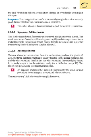 47
the only remaining options are radiation therapy or cryotherapy with liquid
nitrogen.
Prognosis: The changes of successful treatment by surgical excision are very
good. Frequent follow-up examinations are indicated.
The earlier a basal cell carcinoma is detected, the easier it is to remove.
2.7.2.2 Squamous Cell Carcinoma
This is the second most frequently encountered malignant eyelid tumor. The
carcinoma arises from the epidermis, grows rapidly and destroys tissue. It can
metastasize into the regional lymph nodes. Remote metastases are rarer. The
treatment of choice is complete surgical removal.
2.7.2.3 Adenocarcinoma
The rare adenocarcinoma arises from the meibomian glands or the glands of
Zeis. The firm, painless swelling is usually located in the upper eyelid and is
mobile with respect to the skin but not with respect to the underlying tissue.
In its early stages it can be mistaken easily for a chalazion (see p. 39). The
lesion can metastasize into local lymph nodes.
An apparent chalazion that cannot be removed by the usual surgical
procedure always suggests a suspected adenocarcinoma.
The treatment of choice is complete surgical removal.
2.7 Tumors
Lang, Ophthalmology © 2000 Thieme
All rights reserved. Usage subject to terms and conditions of license.
 