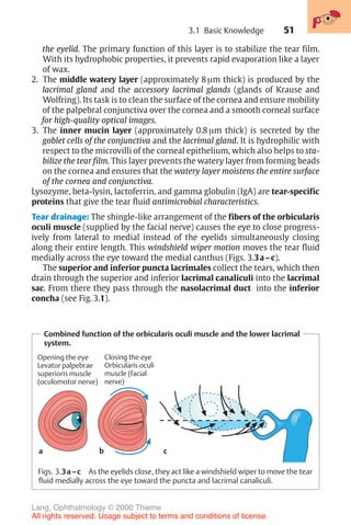 51
the eyelid. The primary function of this layer is to stabilize the tear film.
With its hydrophobic properties, it prevents rapid evaporation like a layer
of wax.
2. The middle watery layer (approximately 8 µm thick) is produced by the
lacrimal gland and the accessory lacrimal glands (glands of Krause and
Wolfring). Its task is to clean the surface of the cornea and ensure mobility
of the palpebral conjunctiva over the cornea and a smooth corneal surface
for high-quality optical images.
3. The inner mucin layer (approximately 0.8 µm thick) is secreted by the
goblet cells of the conjunctiva and the lacrimal gland. It is hydrophilic with
respect to the microvilli of the corneal epithelium, which also helps to sta-
bilize the tear film. This layer prevents the watery layer from forming beads
on the cornea and ensures that the watery layer moistens the entire surface
of the cornea and conjunctiva.
Lysozyme, beta-lysin, lactoferrin, and gamma globulin (IgA) are tear-specific
proteins that give the tear fluid antimicrobial characteristics.
Tear drainage: The shingle-like arrangement of the fibers of the orbicularis
oculi muscle (supplied by the facial nerve) causes the eye to close progress-
ively from lateral to medial instead of the eyelids simultaneously closing
along their entire length. This windshield wiper motion moves the tear fluid
medially across the eye toward the medial canthus (Figs. 3.3a–c).
The superior and inferior puncta lacrimales collect the tears, which then
drain through the superior and inferior lacrimal canaliculi into the lacrimal
sac. From there they pass through the nasolacrimal duct into the inferior
concha (see Fig. 3.1).
Combined function of the orbicularis oculi muscle and the lower lacrimal
system.
Opening the eye
Levator palpebrae
superioris muscle
(oculomotor nerve)
Closing the eye
Orbicularis oculi
muscle (facial
nerve)
Figs. 3.3a–c As the eyelids close, they act like a windshield wiper to move the tear
fluid medially across the eye toward the puncta and lacrimal canaliculi.
a b c
3.1 Basic Knowledge
Lang, Ophthalmology © 2000 Thieme
All rights reserved. Usage subject to terms and conditions of license.
 