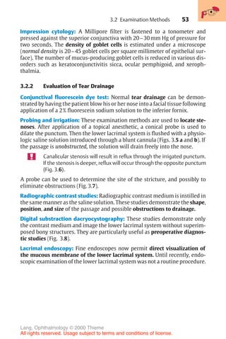 53
Impression cytology: A Millipore filter is fastened to a tonometer and
pressed against the superior conjunctiva with 20–30 mm Hg of pressure for
two seconds. The density of goblet cells is estimated under a microscope
(normal density is 20–45 goblet cells per square millimeter of epithelial sur-
face). The number of mucus-producing goblet cells is reduced in various dis-
orders such as keratoconjunctivitis sicca, ocular pemphigoid, and xeroph-
thalmia.
3.2.2 Evaluation of Tear Drainage
Conjunctival fluorescein dye test: Normal tear drainage can be demon-
strated by having the patient blow his or her nose into a facial tissue following
application of a 2% fluorescein sodium solution to the inferior fornix.
Probing and irrigation: These examination methods are used to locate ste-
noses. After application of a topical anesthetic, a conical probe is used to
dilate the punctum. Then the lower lacrimal system is flushed with a physio-
logic saline solution introduced through a blunt cannula (Figs. 3.5 a and b). If
the passage is unobstructed, the solution will drain freely into the nose.
Canalicular stenosis will result in reflux through the irrigated punctum.
If the stenosis is deeper, reflux will occur through the opposite punctum
(Fig. 3.6).
A probe can be used to determine the site of the stricture, and possibly to
eliminate obstructions (Fig. 3.7).
Radiographic contrast studies: Radiographic contrast medium is instilled in
the same manner as the saline solution. These studies demonstrate the shape,
position, and size of the passage and possible obstructions to drainage.
Digital substraction dacryocystography: These studies demonstrate only
the contrast medium and image the lower lacrimal system without superim-
posed bony structures. They are particularly useful as preoperative diagnos-
tic studies (Fig. 3.8).
Lacrimal endoscopy: Fine endoscopes now permit direct visualization of
the mucous membrane of the lower lacrimal system. Until recently, endo-
scopic examination of the lower lacrimal system was not a routine procedure.
3.2 Examination Methods
Lang, Ophthalmology © 2000 Thieme
All rights reserved. Usage subject to terms and conditions of license.
 