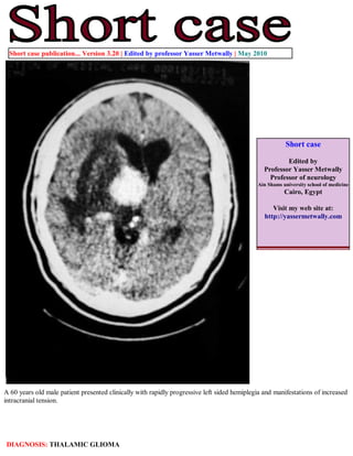Short case publication... Version 3.20 | Edited by professor Yasser Metwally | May 2010




                                                                                                        Short case

                                                                                                        Edited by
                                                                                                Professor Yasser Metwally
                                                                                                  Professor of neurology
                                                                                             Ain Shams university school of medicine
                                                                                                        Cairo, Egypt

                                                                                                   Visit my web site at:
                                                                                                http://yassermetwally.com




A 60 years old male patient presented clinically with rapidly progressive left sided hemiplegia and manifestations of increased
intracranial tension.




DIAGNOSIS: THALAMIC GLIOMA
 