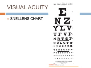 VISUAL ACUITY
 SNELLENS CHART
 