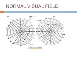 NORMAL VISUAL FIELD
 