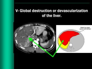 Imaging in abdominal trauma | PPTX