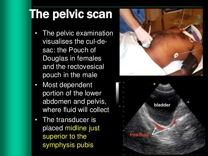 Imaging in abdominal trauma