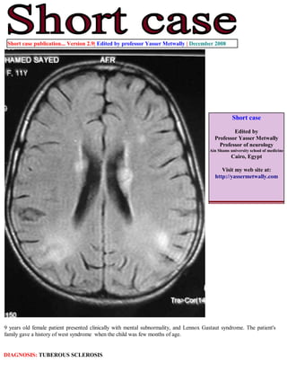 Short case publication... Version 2.9| Edited by professor Yasser Metwally | December 2008




                                                                                                  Short case

                                                                                                 Edited by
                                                                                         Professor Yasser Metwally
                                                                                           Professor of neurology
                                                                                       Ain Shams university school of medicine
                                                                                                  Cairo, Egypt

                                                                                             Visit my web site at:
                                                                                          http://yassermetwally.com




9 years old female patient presented clinically with mental subnormality, and Lennox Gastaut syndrome. The patient's
family gave a history of west syndrome when the child was few months of age.


DIAGNOSIS: TUBEROUS SCLEROSIS
 