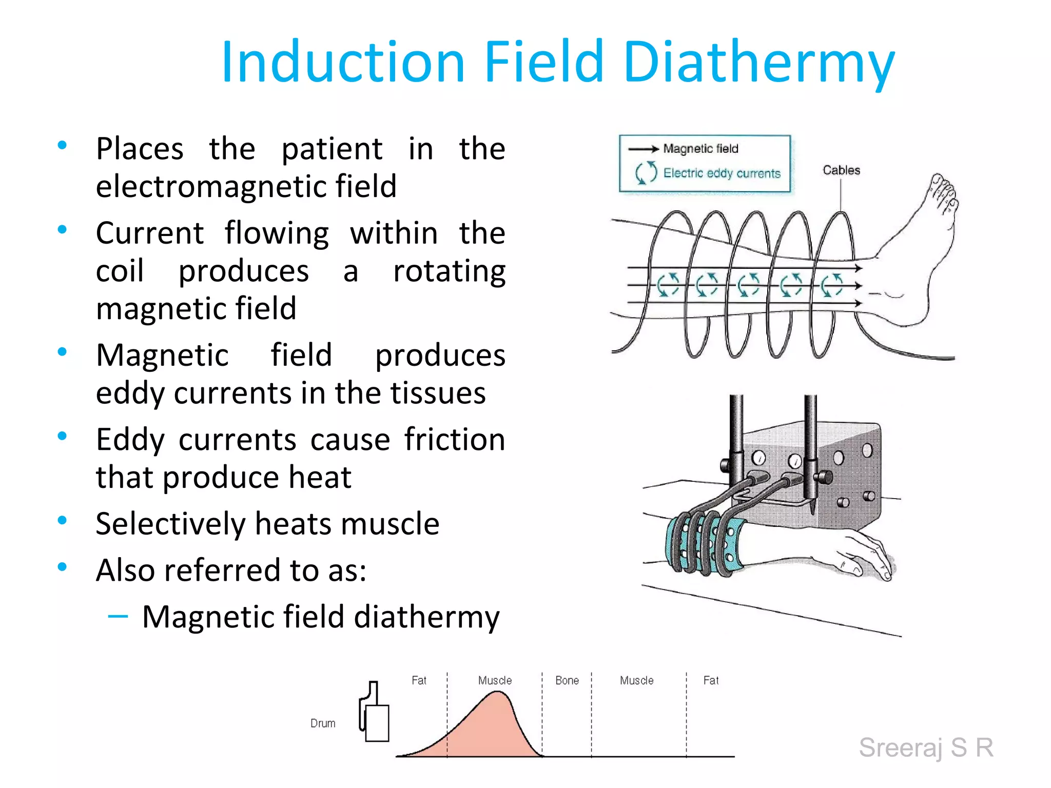 Sreeraj S R
Induction Field Diathermy
• Places the patient in the
electromagnetic field
• Current flowing within the
coil produces a rotating
magnetic field
• Magnetic field produces
eddy currents in the tissues
• Eddy currents cause friction
that produce heat
• Selectively heats muscle
• Also referred to as:
– Magnetic field diathermy
 