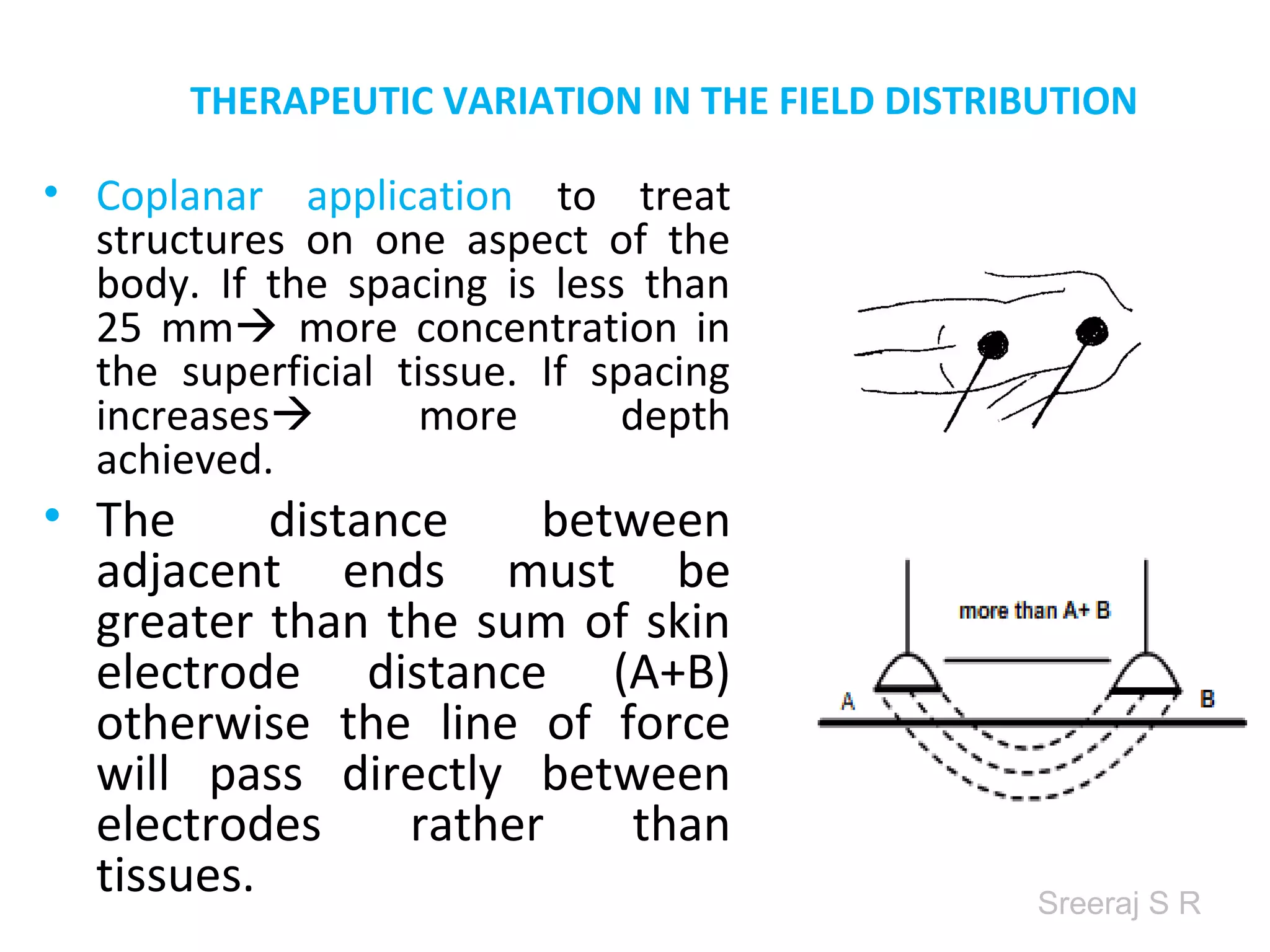 Sreeraj S R
THERAPEUTIC VARIATION IN THE FIELD DISTRIBUTION
• Coplanar application to treat
structures on one aspect of the
body. If the spacing is less than 25
mm more concentration in the
superficial tissue. If spacing
increases more depth achieved.
• The distance between
adjacent ends must be
greater than the sum of skin
electrode distance (A+B)
otherwise the line of force
will pass directly between
electrodes rather than
tissues.
 