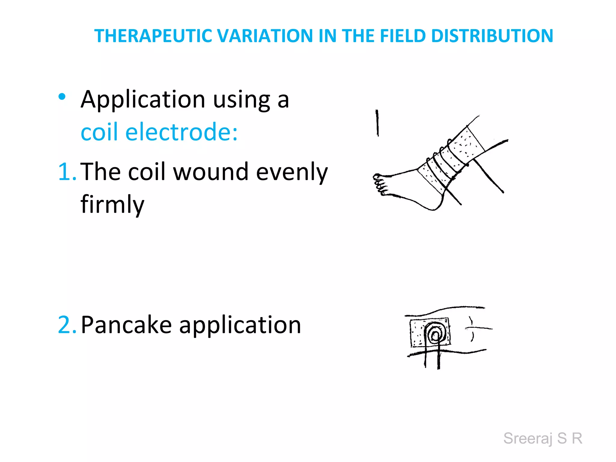 Sreeraj S R
THERAPEUTIC VARIATION IN THE FIELD DISTRIBUTION
• Application using a
coil electrode:
1. The coil wound
evenly firmly
2. Pancake application
 
