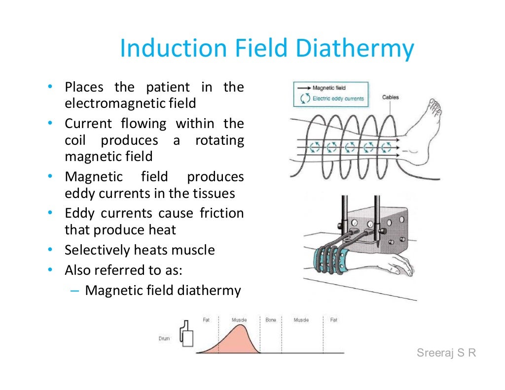 Short wave diathermy srs