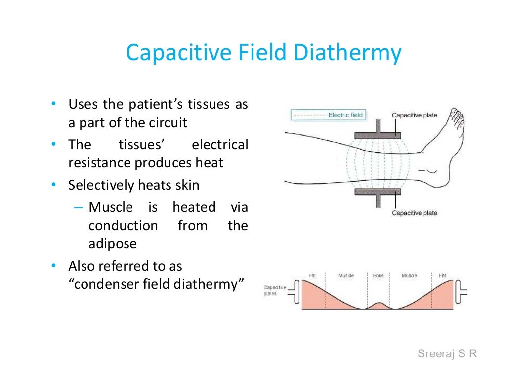 Short wave diathermy srs
