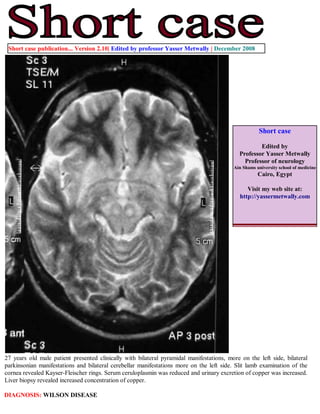 Short case publication... Version 2.10| Edited by professor Yasser Metwally | December 2008




                                                                                                     Short case

                                                                                                     Edited by
                                                                                             Professor Yasser Metwally
                                                                                               Professor of neurology
                                                                                          Ain Shams university school of medicine
                                                                                                     Cairo, Egypt

                                                                                                Visit my web site at:
                                                                                             http://yassermetwally.com




27 years old male patient presented clinically with bilateral pyramidal manifestations, more on the left side, bilateral
parkinsonian manifestations and bilateral cerebellar manifestations more on the left side. Slit lamb examination of the
cornea revealed Kayser-Fleischer rings. Serum ceruloplasmin was reduced and urinary excretion of copper was increased.
Liver biopsy revealed increased concentration of copper.

DIAGNOSIS: WILSON DISEASE
 