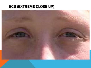 ECU (EXTREME CLOSE UP)
 