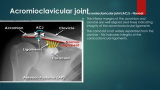 Normal Acj RADIOLOGICAL ANATOMY OF UPPER LIMB(SHOULDER@ELBOW) | PPTX