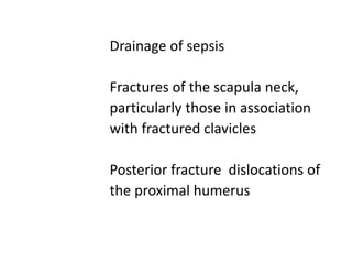 Drainage of sepsis
Fractures of the scapula neck,
particularly those in association
with fractured clavicles
Posterior fracture dislocations of
the proximal humerus
 
